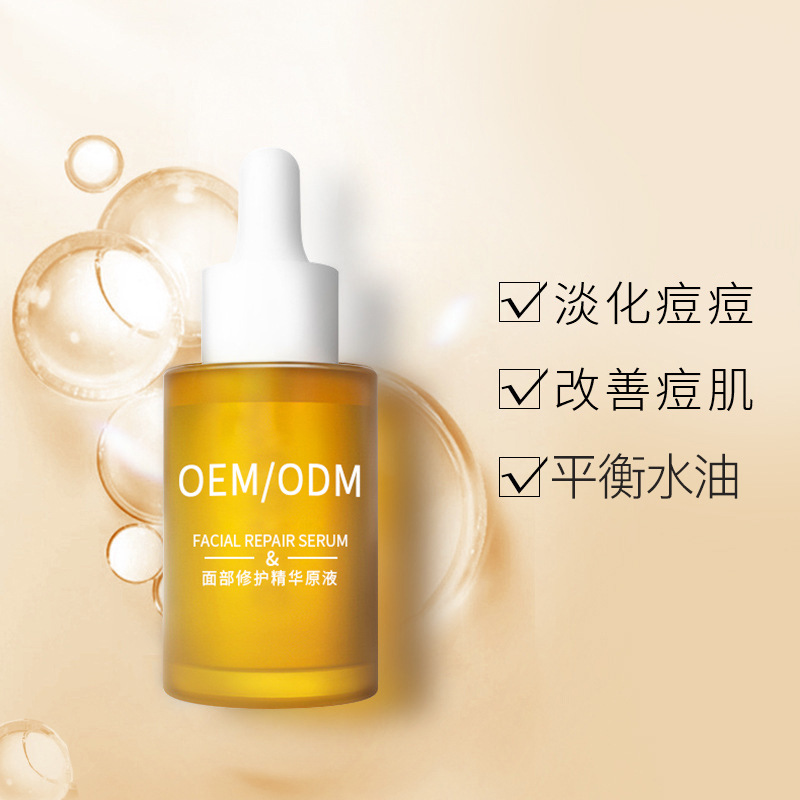 肇庆市_祛痘精华原液OEM